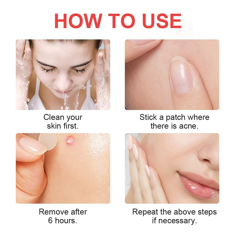Invisible Acne Patch Overnight Hydrocolloid Pimple Patches for Clear Smooth Skin❤