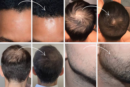🔥Summer Promotion🔥Hairline Powder - Instant Coverage for Thinning or Balding Areas