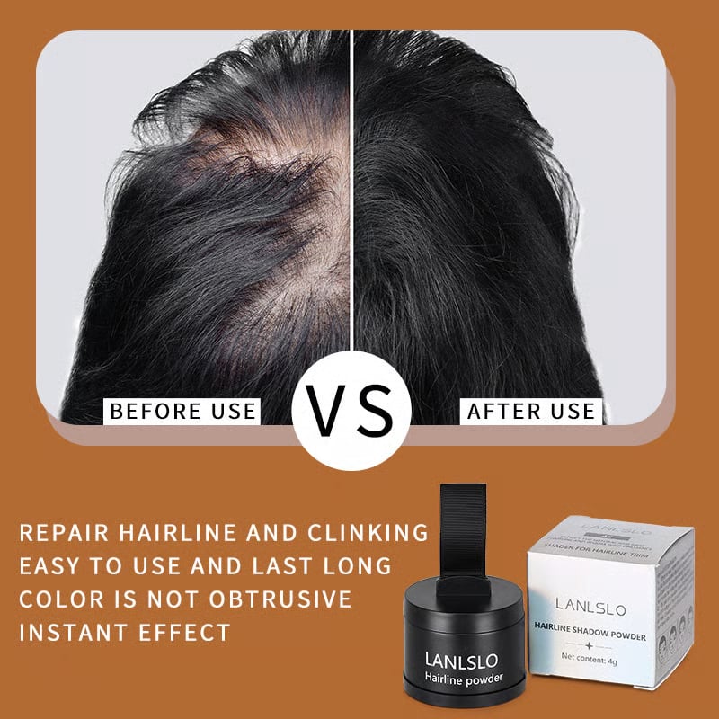 🔥Summer Promotion🔥Hairline Powder - Instant Coverage for Thinning or Balding Areas