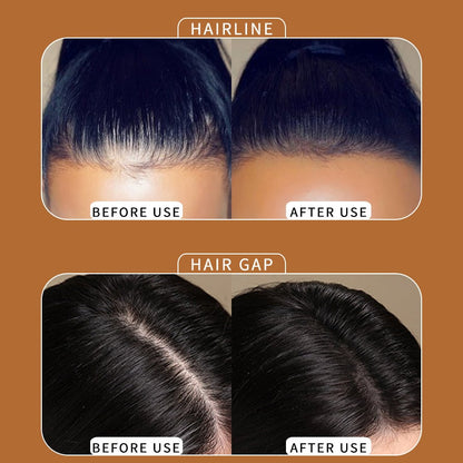 🔥Summer Promotion🔥Hairline Powder - Instant Coverage for Thinning or Balding Areas