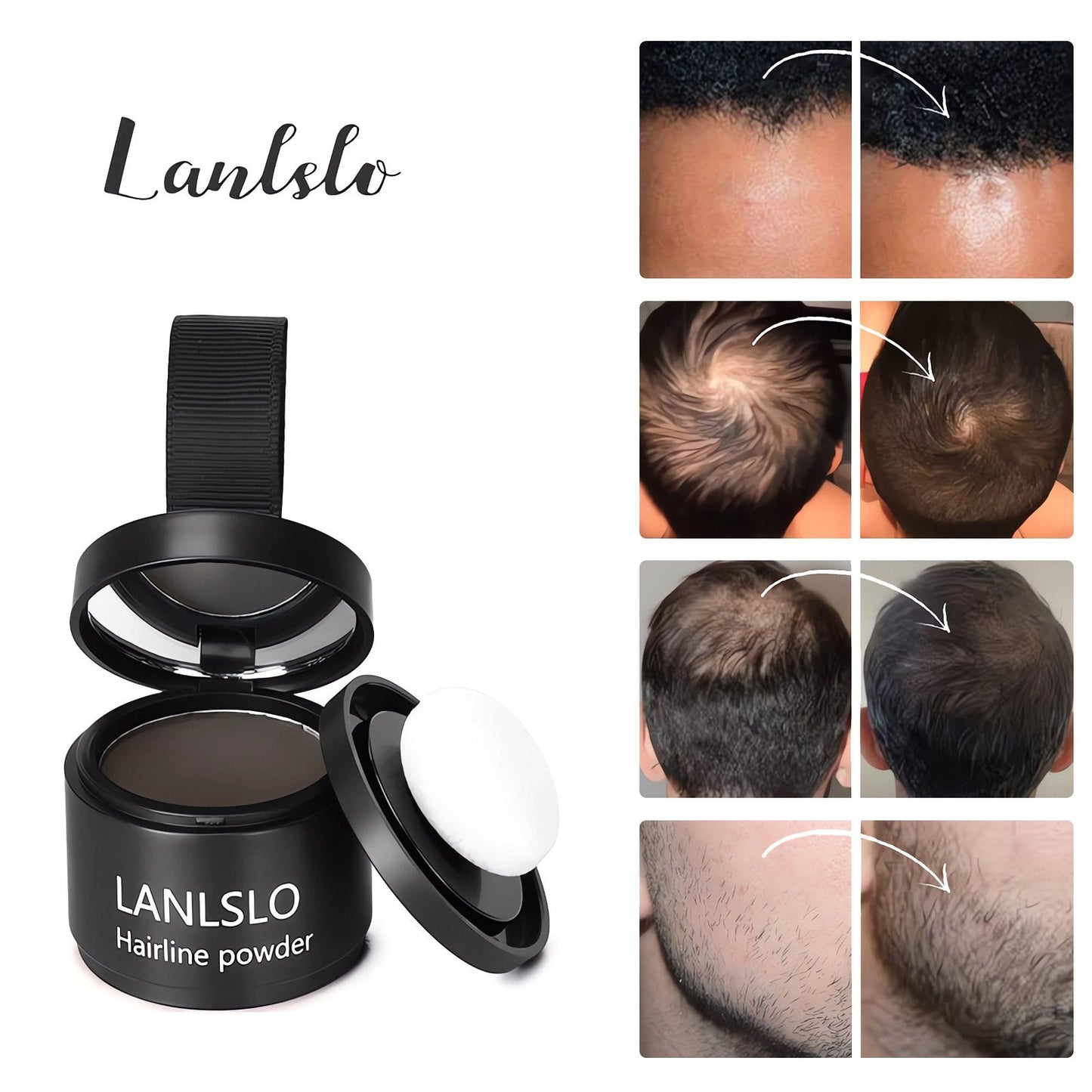 🔥Summer Promotion🔥Hairline Powder - Instant Coverage for Thinning or Balding Areas